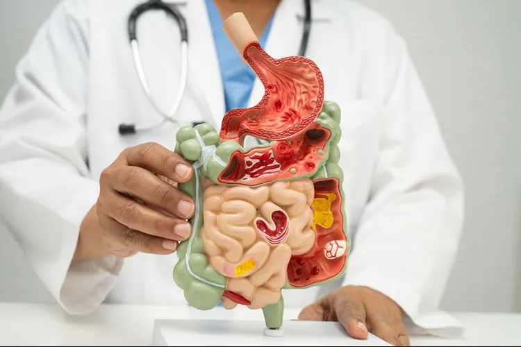 Doctor holding anatomical gut model — Akkermansia muciniphila supports gut barrier integrity and reduces intestinal permeability